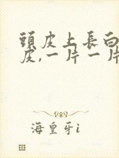 头皮上长白色的皮,一片一片的