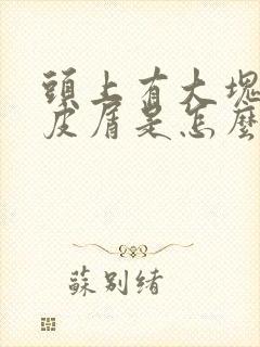 头上有大块状头皮屑是怎么回事