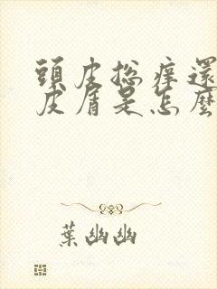 头皮总痒还有头皮屑是怎么回事