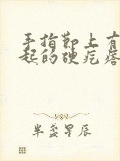 手指节上有个凸起的硬疙瘩还隐隐疼封面