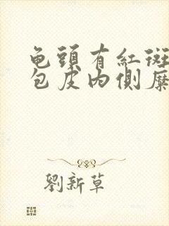 龟头有红斑瘙痒包皮内侧糜烂