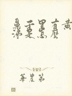 鼻子里有黄脓鼻涕是怎么