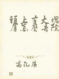 头上有大块头皮屑怎么去除