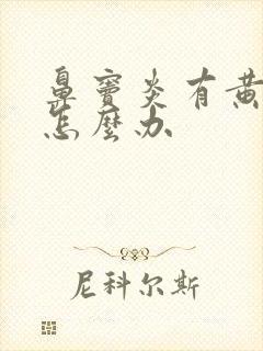 鼻窦炎有黄鼻涕怎么办