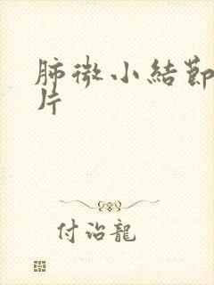 肺微小结节ct片