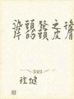 染头发之后有大片的头皮屑怎么办