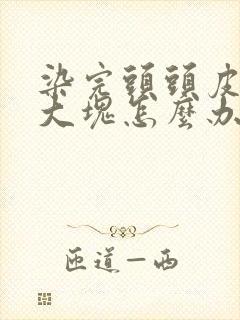 染完头头皮屑超大块怎么办