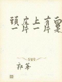 头皮上有白色的一片一片是怎么了封面