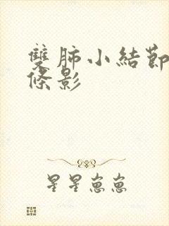 双肺小结节和索条影