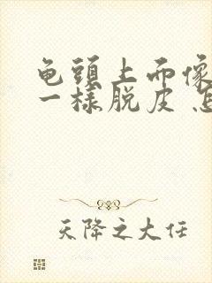 龟头上面像白色一样脱皮 怎么回事啊