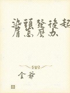 染头发后起头皮屑怎么办封面