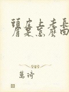 头皮上老长头皮屑是怎么回事