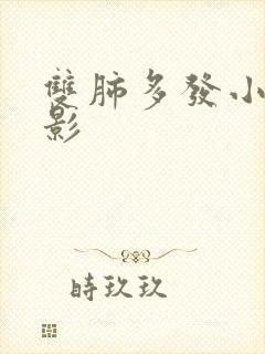 双肺多发小结节影