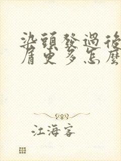 染头发过后头皮屑更多怎么办