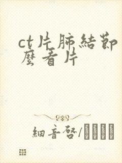 ct片肺结节怎么看片