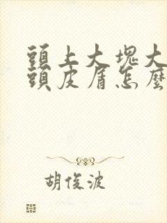 头上大块大块的头皮屑怎么治疗