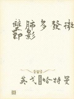 双肺多发微小结节影封面