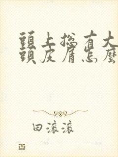 头上总有大块的头皮屑怎么回事