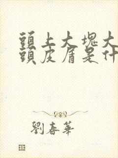 头上大块大块的头皮屑是什么原因