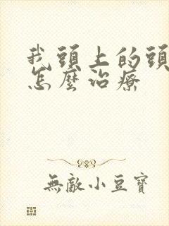 我头上的头皮屑怎么治疗