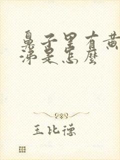 鼻子里有黄脓鼻涕是怎么