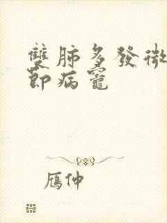 双肺多发微小结节病灶