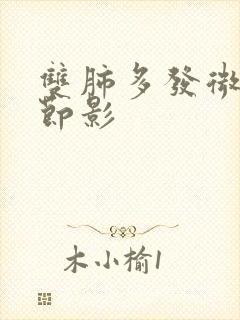 双肺多发微小结节影封面