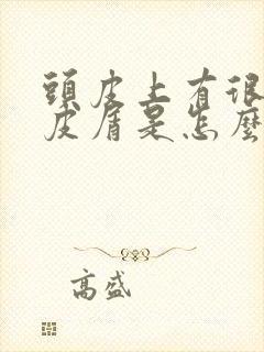 头皮上有很多头皮屑是怎么回事封面