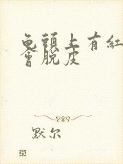 龟头上有红点还会脱皮封面