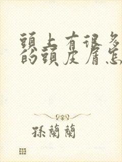 头上有很多大块的头皮屑怎么回事