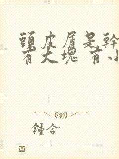 头皮屑是干的他有大块 有小沫沫