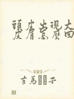 头皮出现大块头皮屑怎么回事