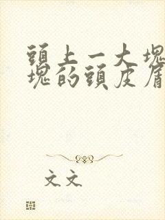 头上一大块一大块的头皮屑怎么办啊