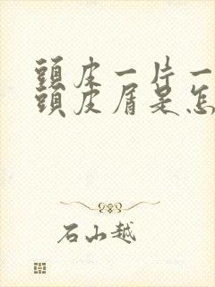 头皮一片一片的头皮屑是怎么回事