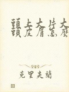 头上大片大片的头皮屑怎么回事怎么办