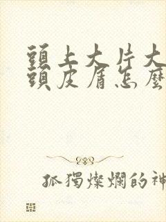 头上大片大片的头皮屑怎么回事怎么办