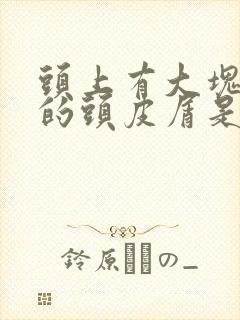 头上有大块大块的头皮屑是怎么回事