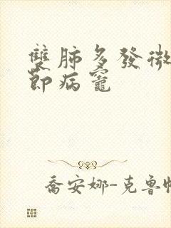 双肺多发微小结节病灶