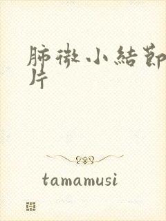 肺微小结节ct片