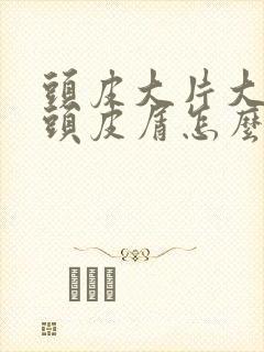 头皮大片大片的头皮屑怎么治疗