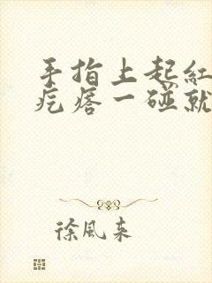 手指上起红色的疙瘩一碰就疼