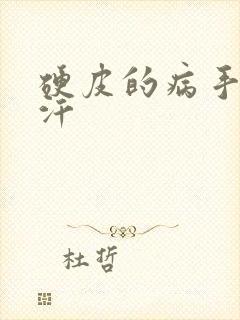 硬皮的病手心出汗