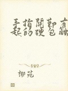 手指关节有个凸起的硬包触痛