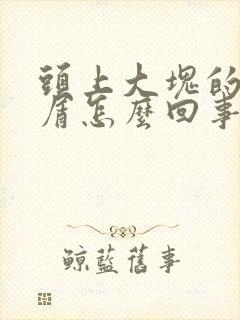 头上大块的头皮屑怎么回事