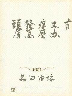 头发痒又有头皮屑怎么办