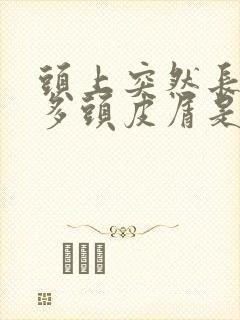 头上突然长了很多头皮屑是怎么回事