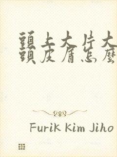 头上大片大片的头皮屑怎么回事怎么办