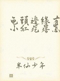 龟头边缘有一排小红疙瘩怎么办封面