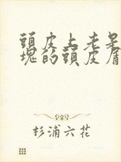 头皮上老是有大块的头皮屑怎么回事