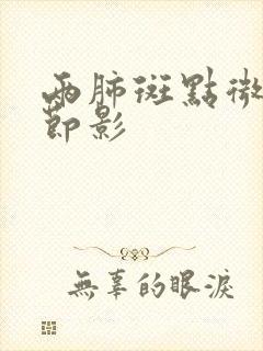 两肺斑点微小结节影封面